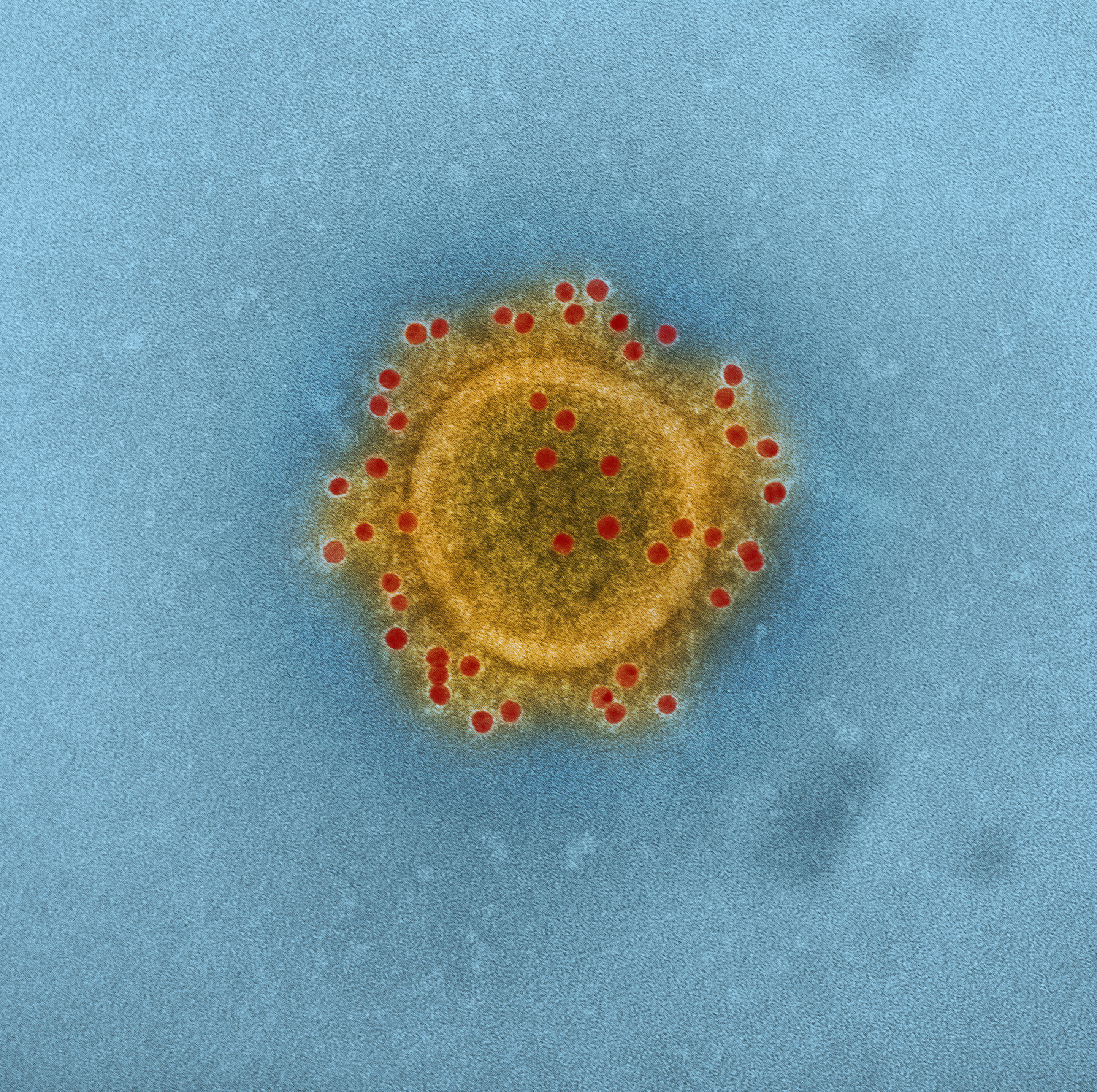  közel-keleti légúti koronavírus